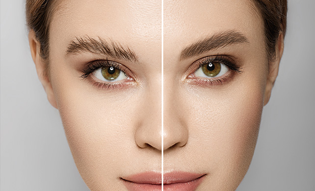Eyebrow Transplant