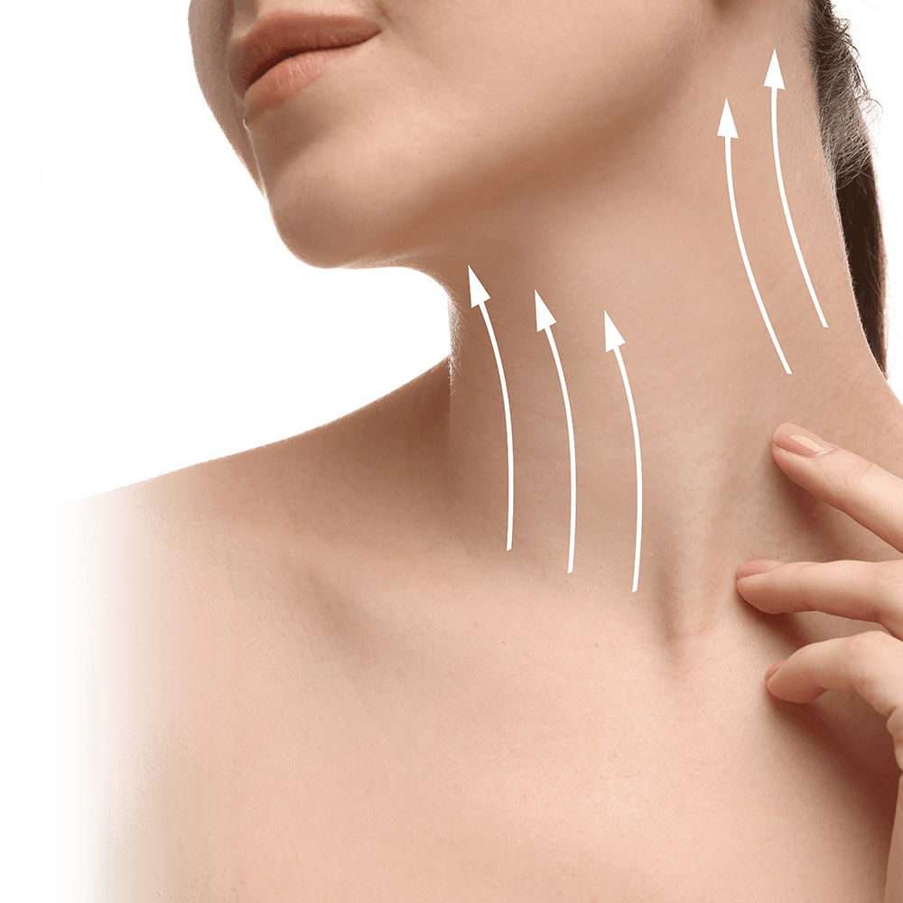 Neck Lift