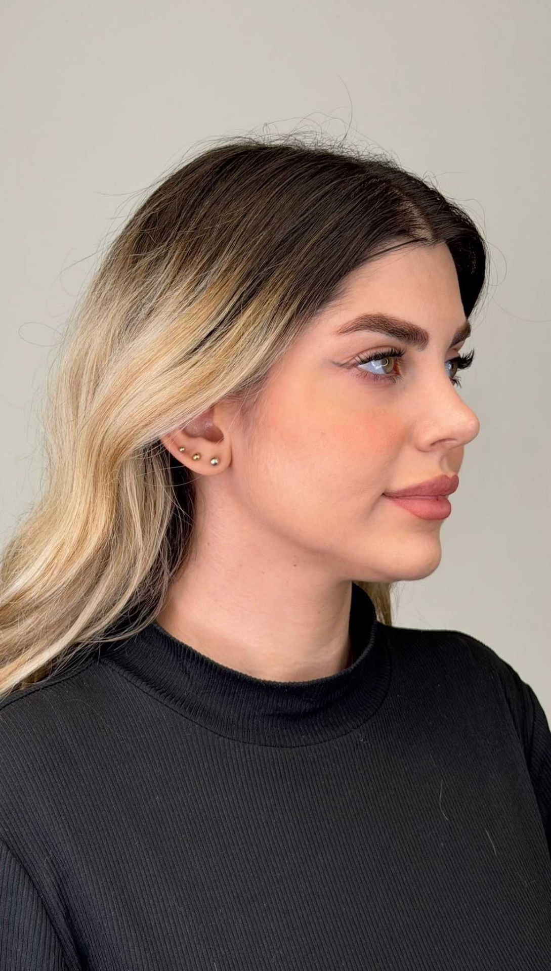 before procedure