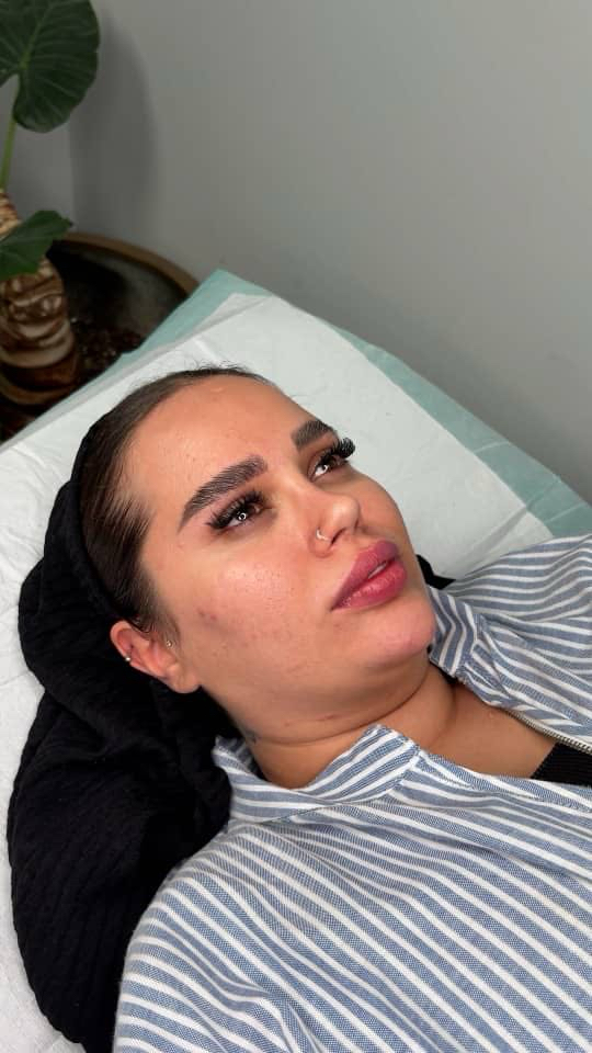 before procedure
