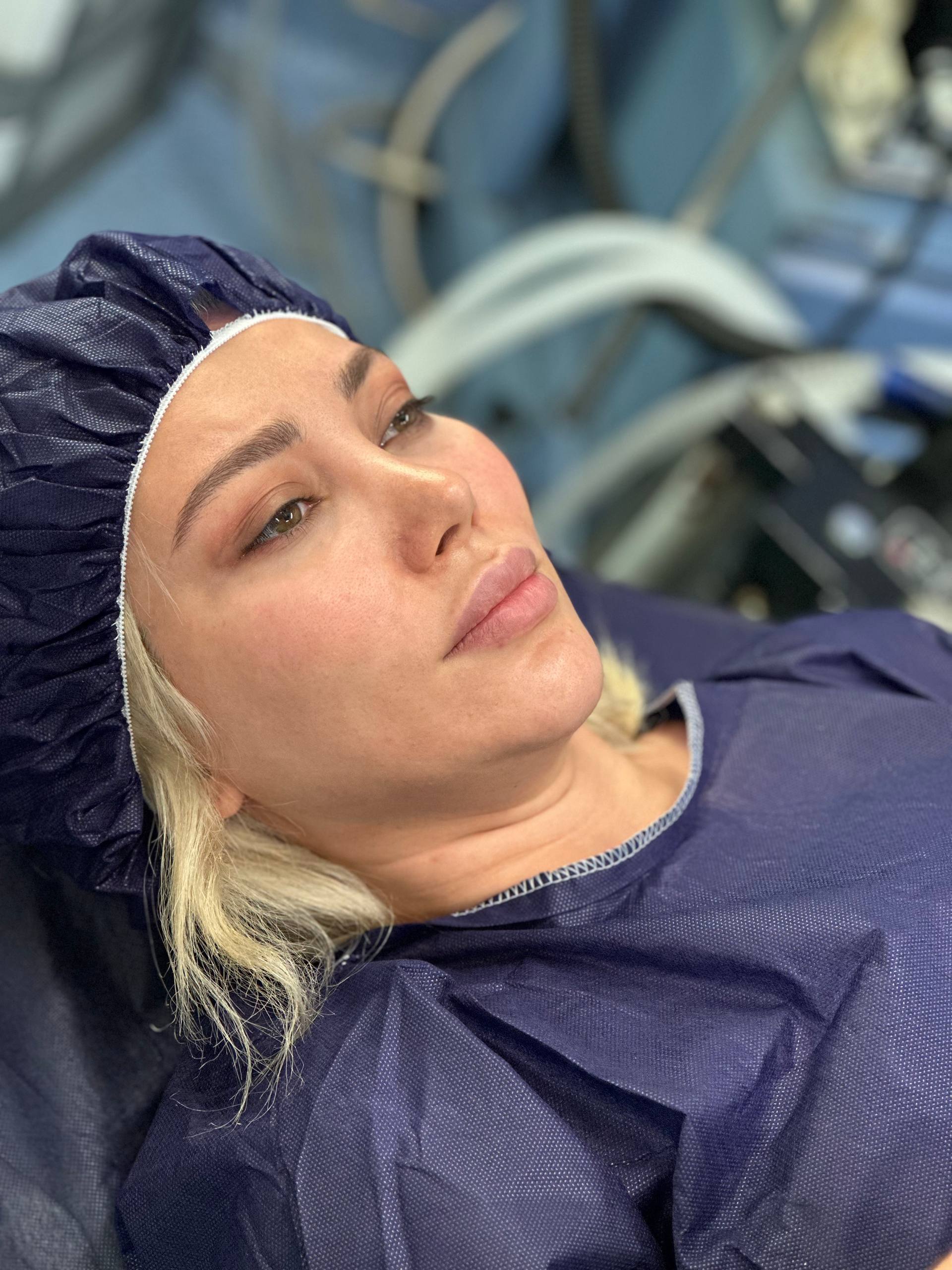 Double chin procedure