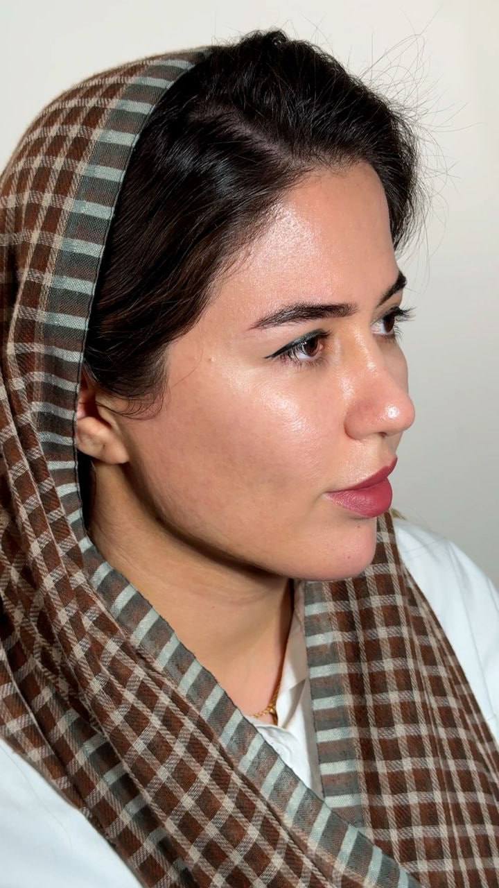 Double chin procedure