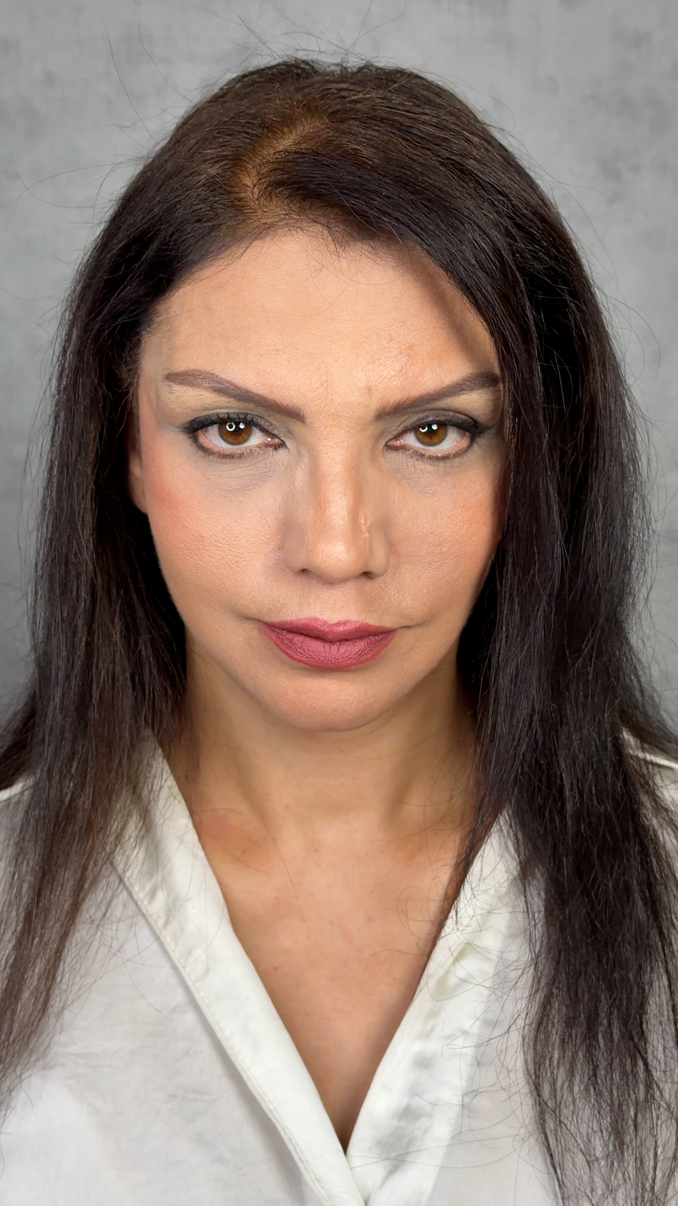 After Procedure