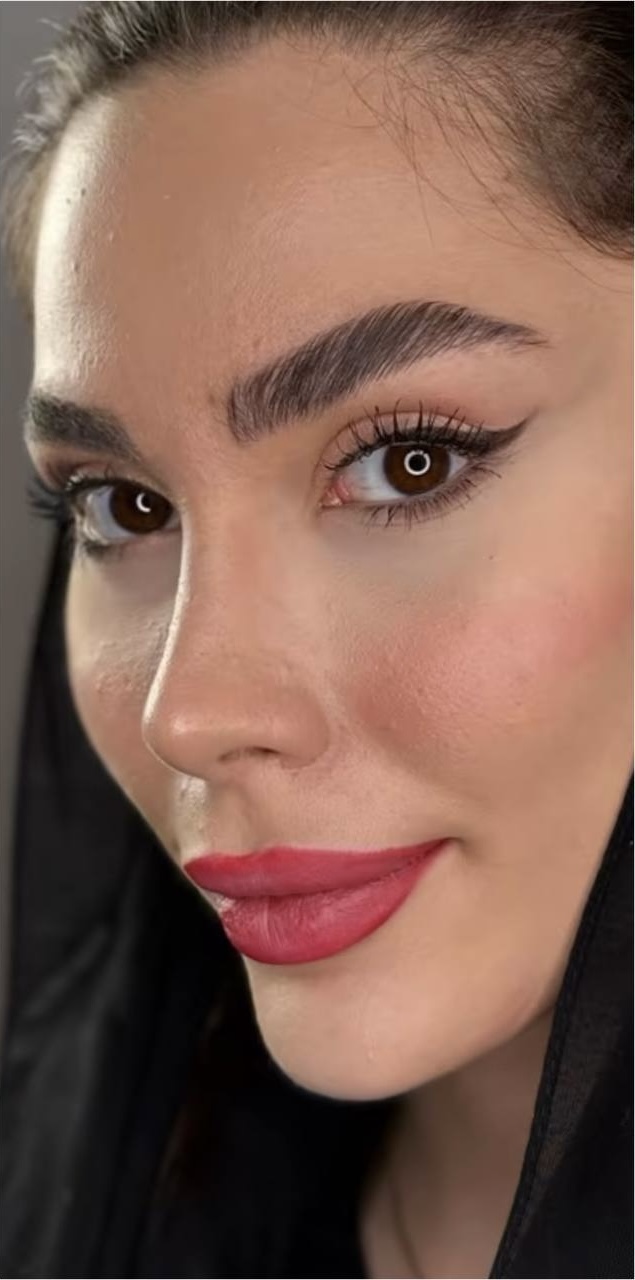 After Procedure