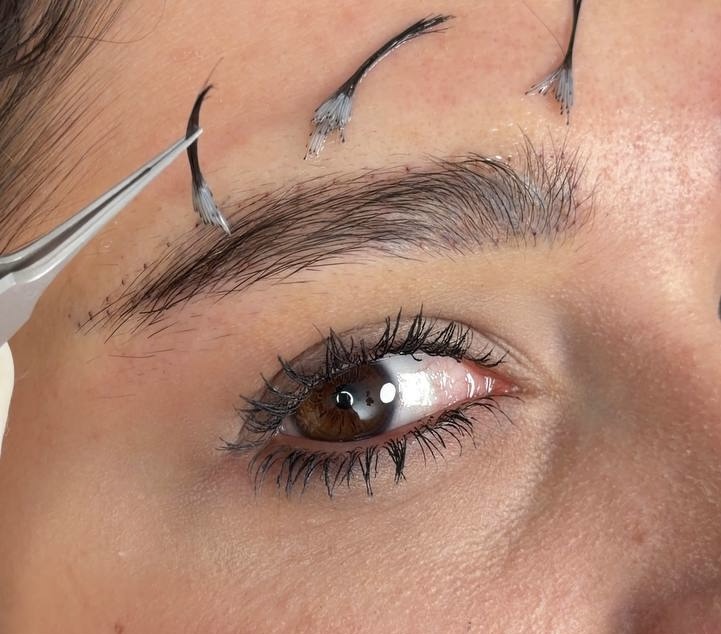 Before Procedure
