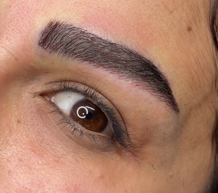 After procedure