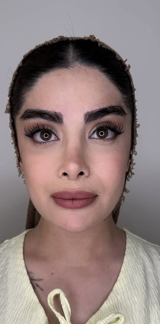 Before Procedure