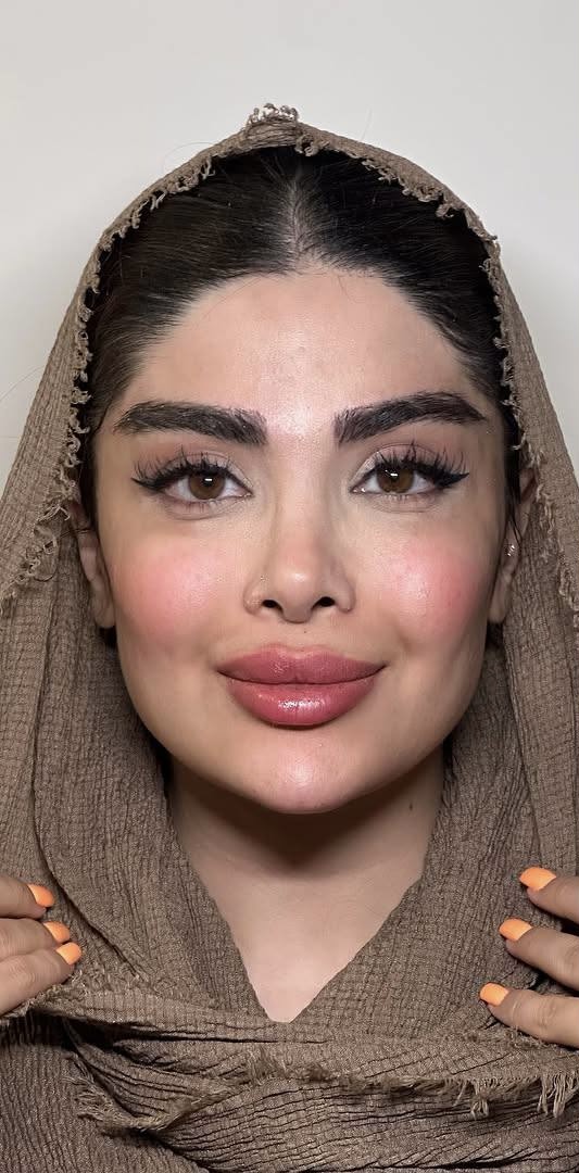 After Procedure