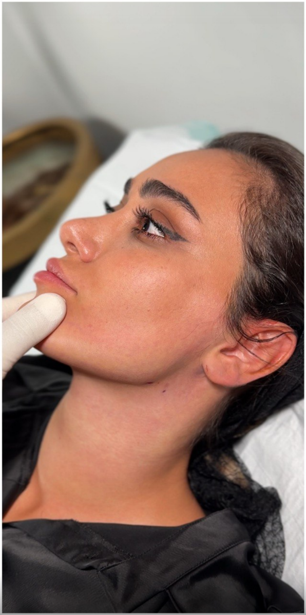 after procedure