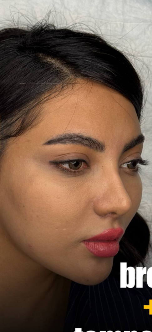 before procedure