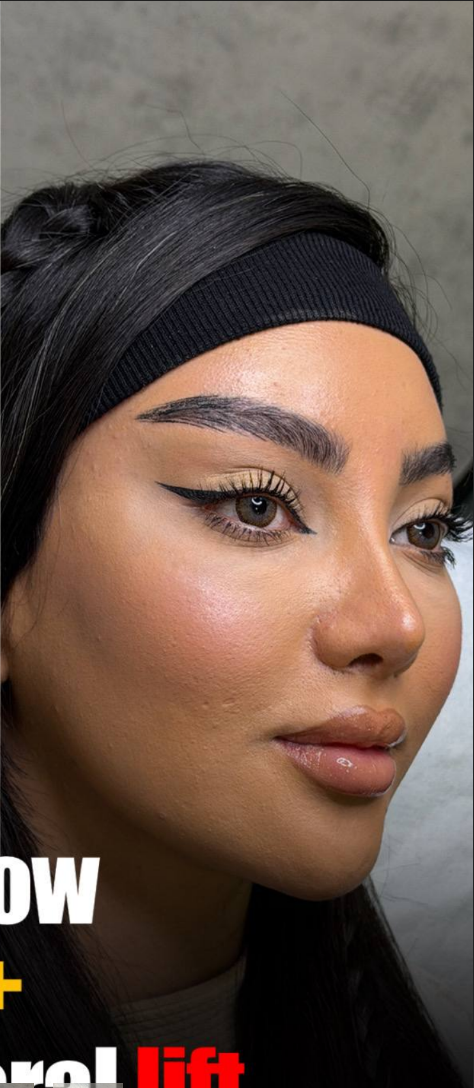 after procedure