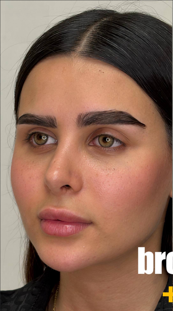 before procedure