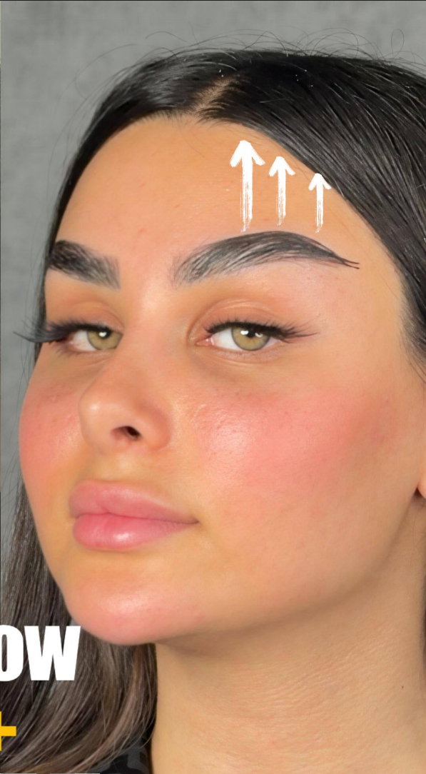after procedure