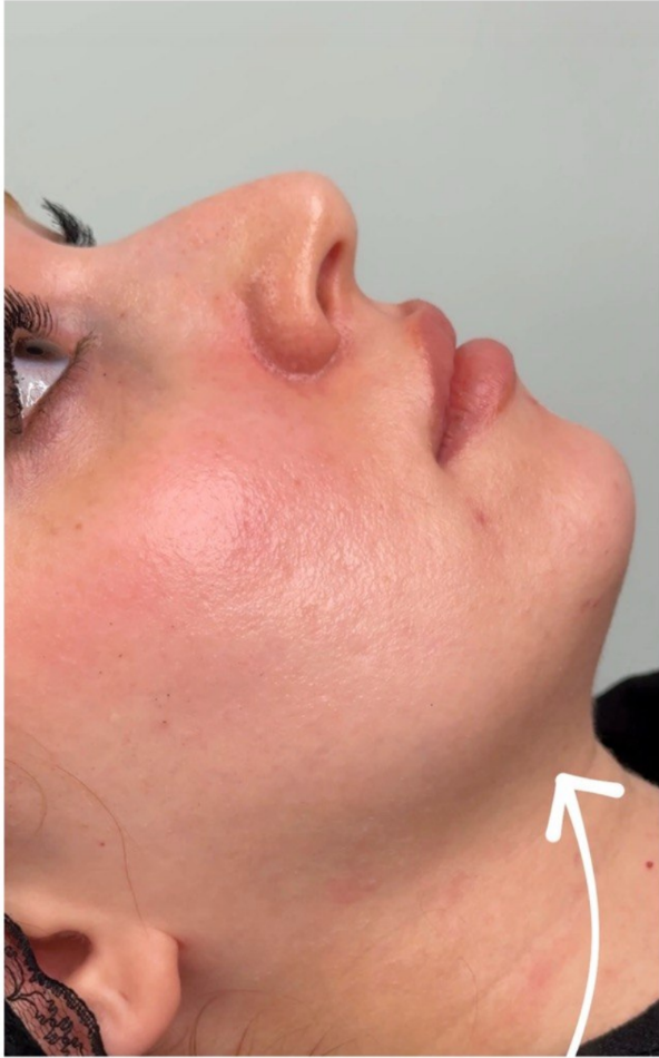before procedure