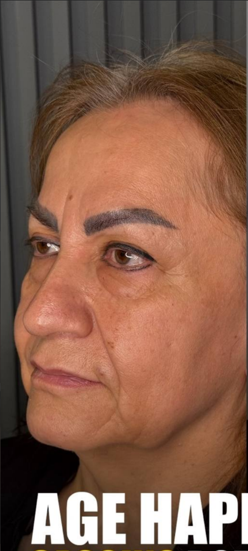 before procedure
