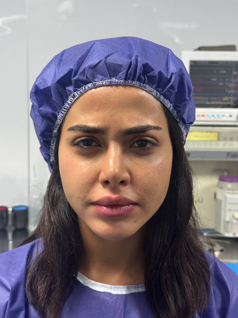 before procedure