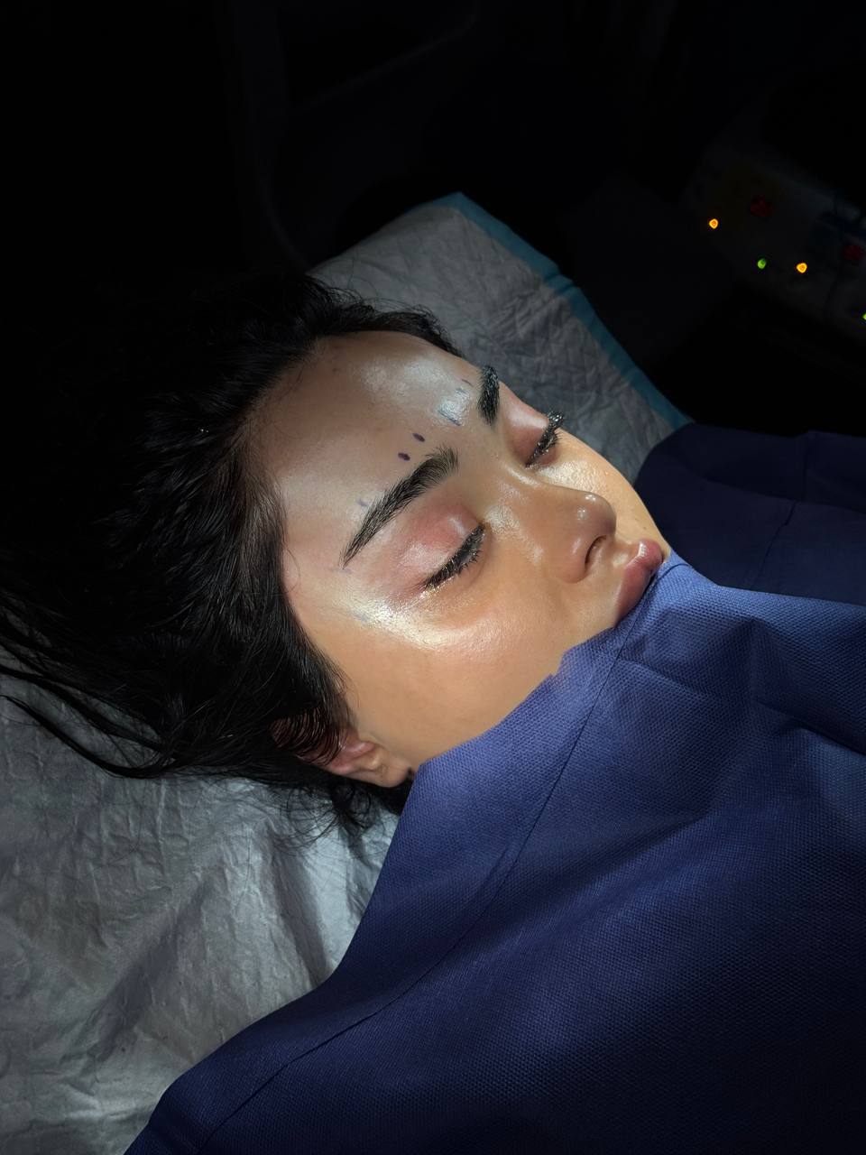 after procedure at surgery room