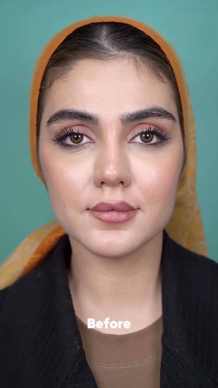 before procedure