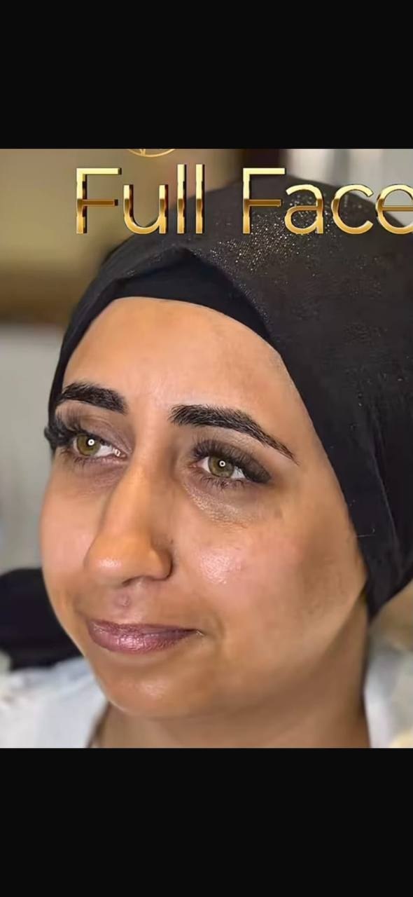before procedure
