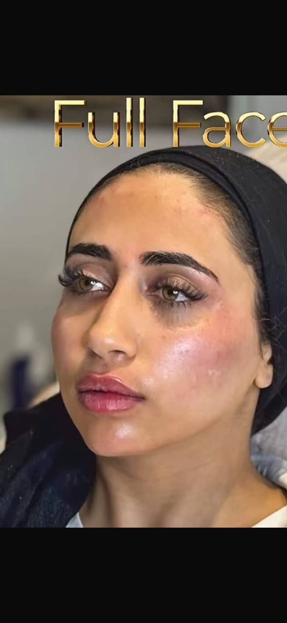 after procedure
